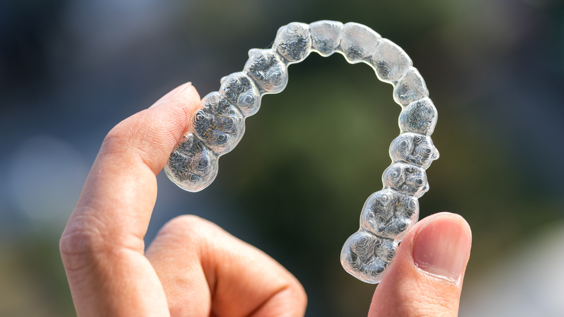 Invisalign for Teens: 5 Must-Know Benefits for a Confident Smile 1