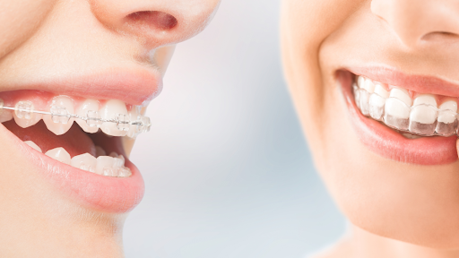 How High-Tech Treatment at Bastian Orthodontics Helps Families Save Time and Money 1