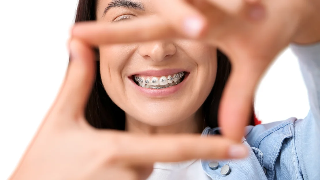 Orthodontic Emergencies 1